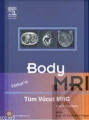 Body Mrı